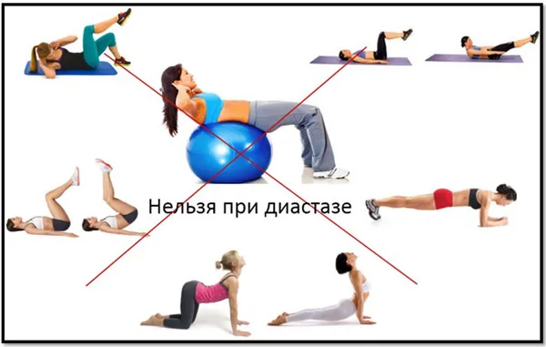 nelzya_pri_diastaze.jpg