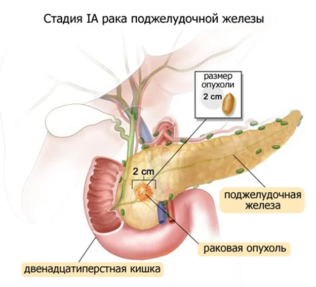 podgeludochnaya_3.jpg