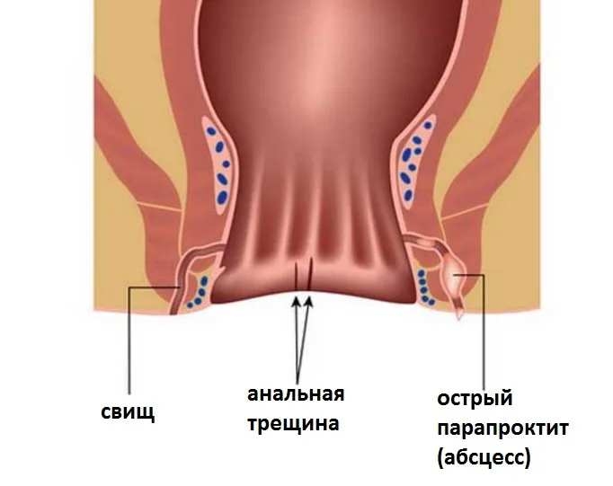 svish_pryamoi_kishki.jpg