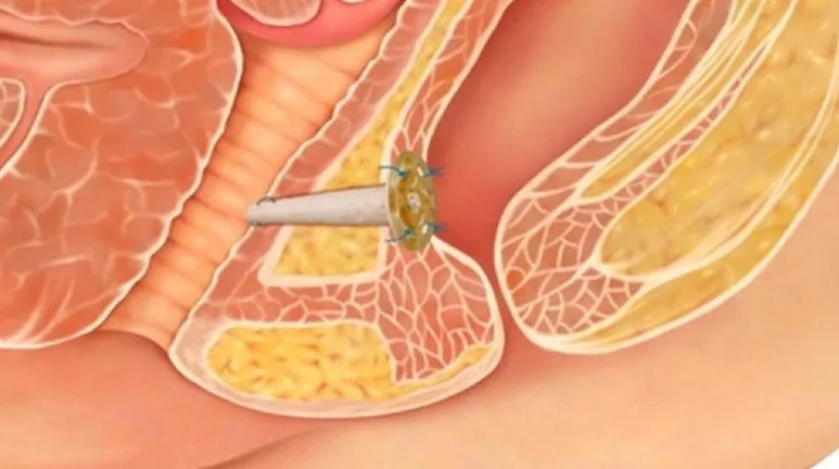 Screenshot_22.jpg