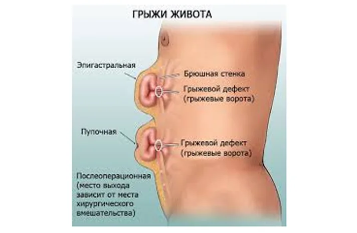 gryga_beloi_linii_zhivota.jpg
