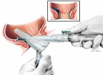 restoromonoscop.jpg