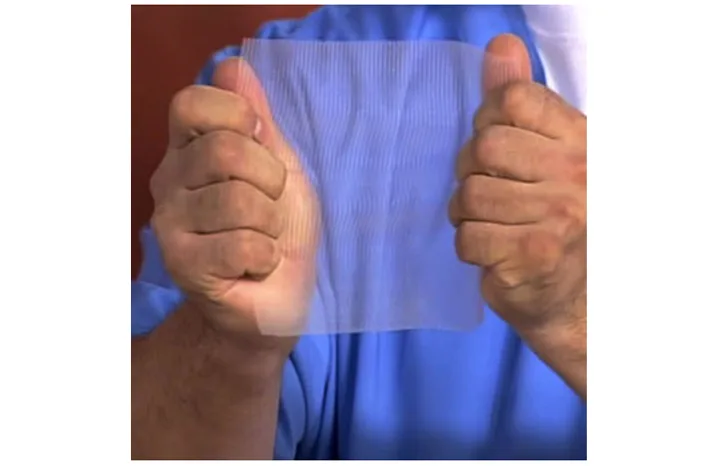 sinteticheskie_endoprotezy_setki.jpg